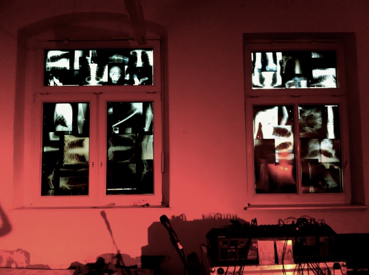 Röntgenbilder im Hauptraum, Foto: Hanne Lauch